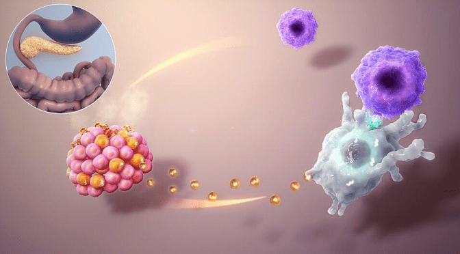 The Beta Cells (orange in the lower left cell bundle) are part the insulin-producing cells of the pancreas (the bright highlighted organ in circular picture). In an autoimmune-type attack type 1 Diabetes, the physiologically secreted exosomes (the yellow dots) of the beta cells are wrongly taken up by dendritic cells (big whitish cell with arms) with their contents being presented to T-cells (smaller blue cells in the upper right) . The T-Cells see those contents (proteins) as enemies and attack their producers. This leads to a loss of functional beta cells and a decreased production of insulin.
